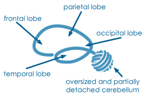 Brain logo dissection